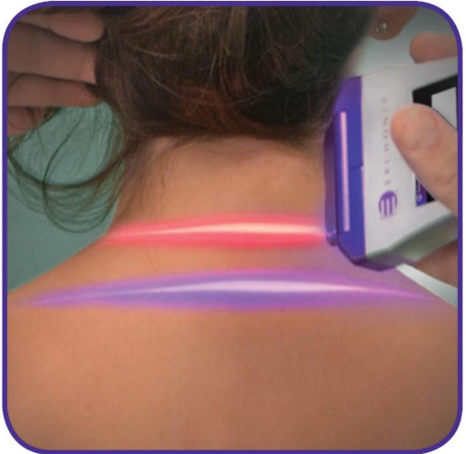 laser therapy in Tustin pain relief healing